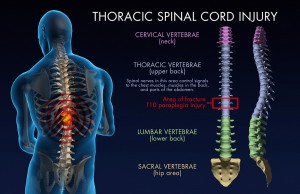 Medical - Back Pain